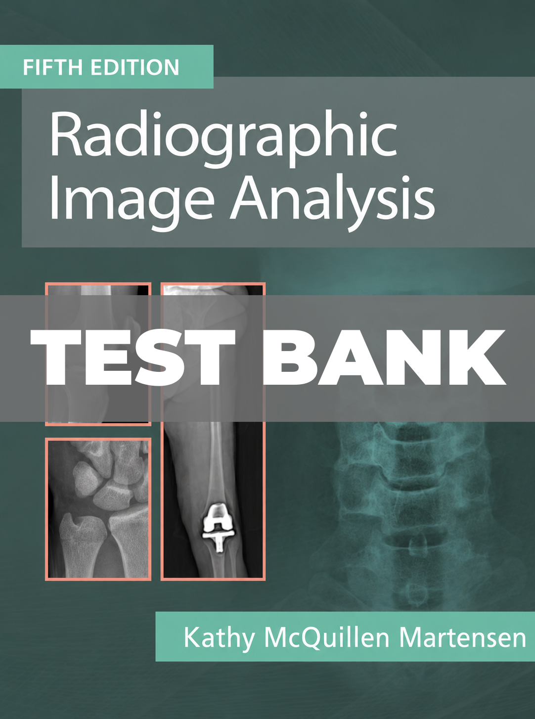 Test Bank For Radiographic Image Analysis 5th Edition Martensen